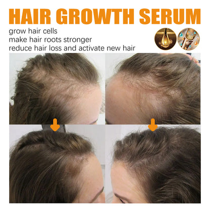 Hair Growth Repair Care Essential Oil - Hiccupzz